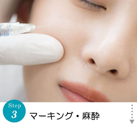 マーキング・麻酔