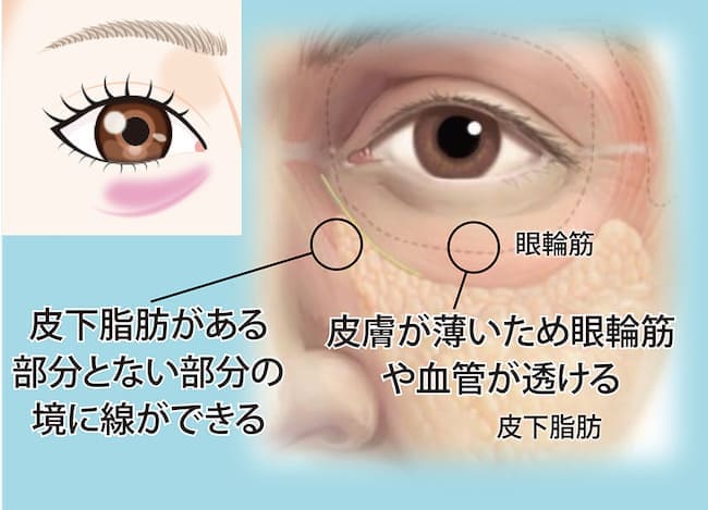 紫グマ（青グマ）：皮膚が薄く、筋肉や血管の色が透けて見える。