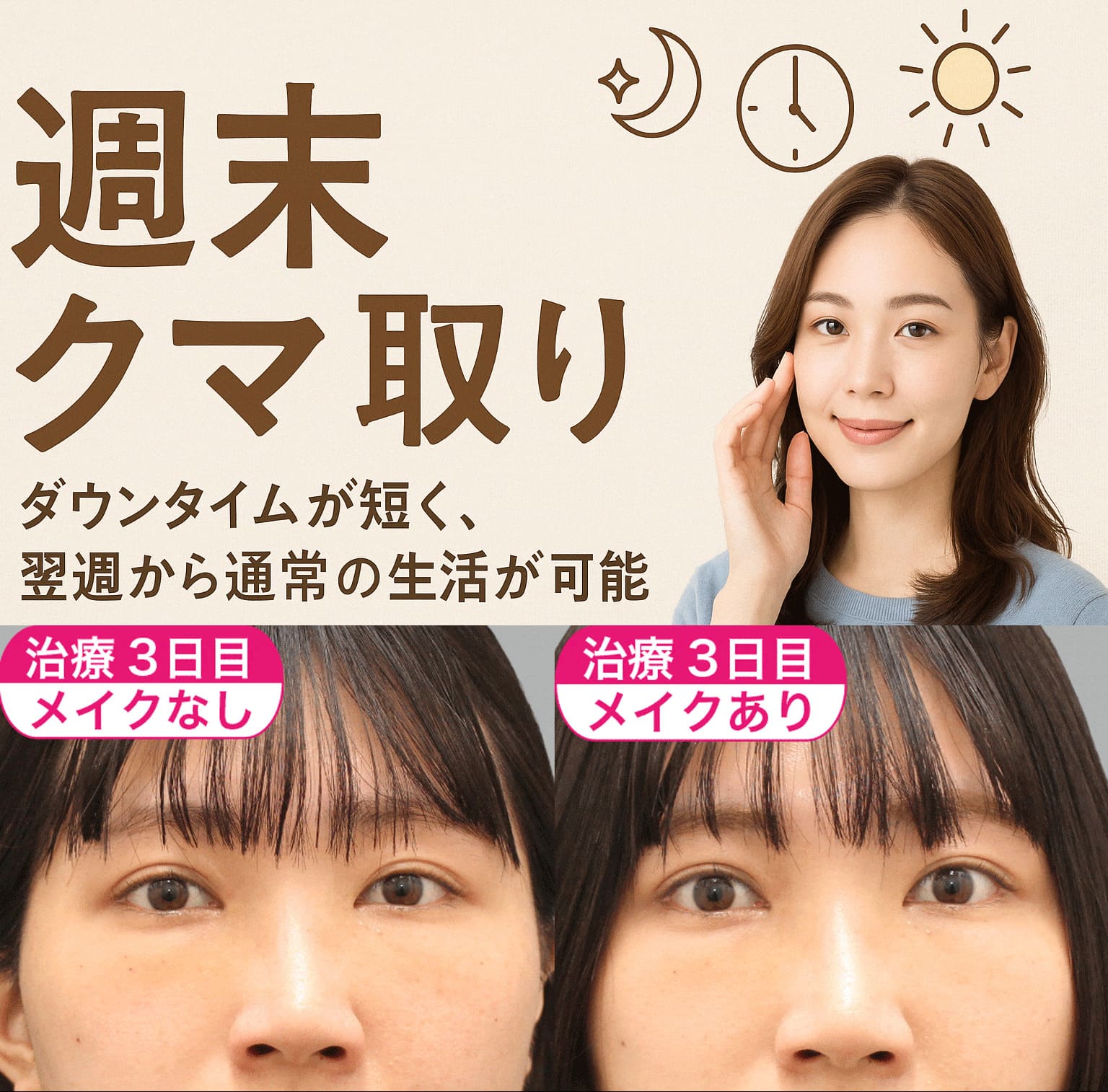 週末で変わる「目の下のくま」治療