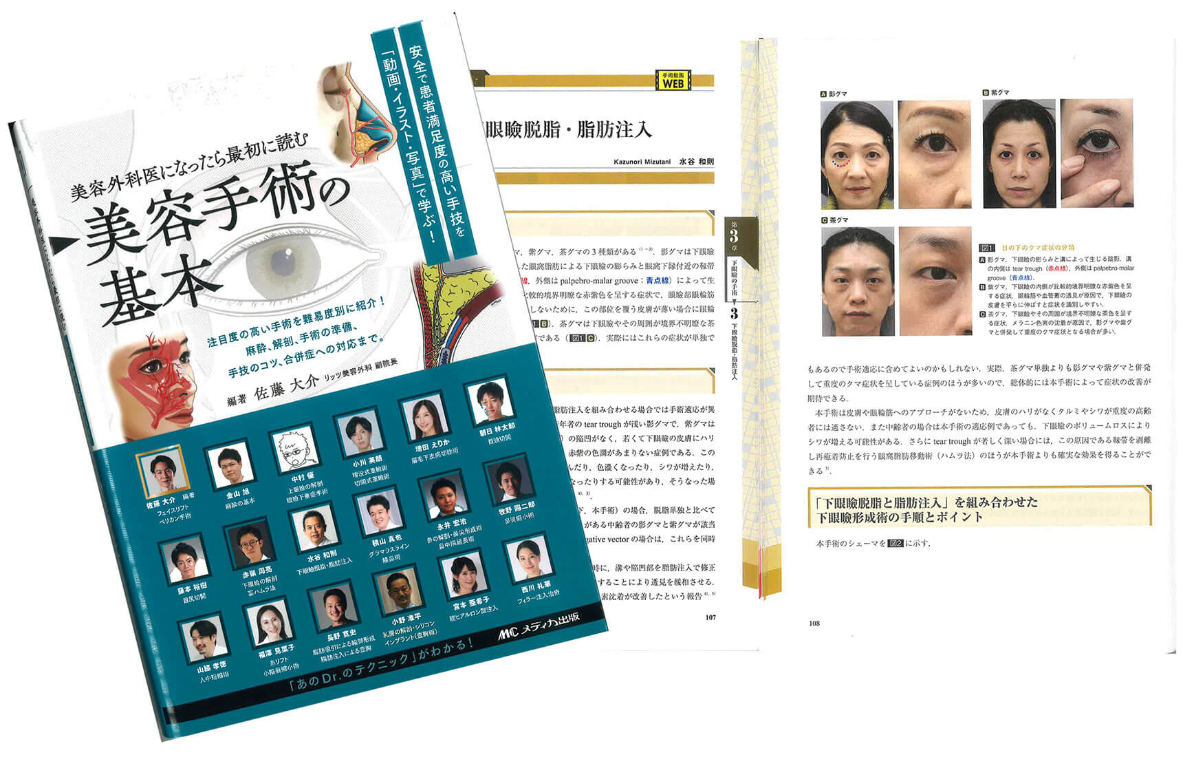 目の下のくま治療の文献・書籍を執筆・監修