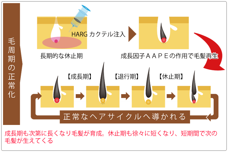 ハーグによる正常な毛周期の再生