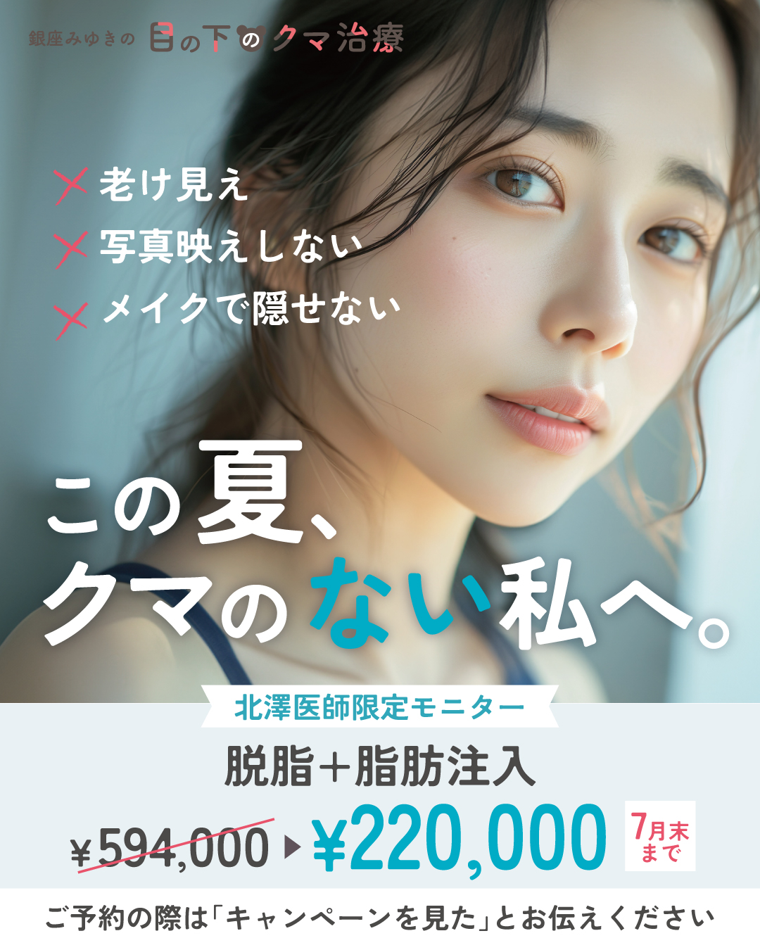 7月キャンペーン北澤医師限定！目の下のくま脱脂＋脂肪注入594000円→220,000円！