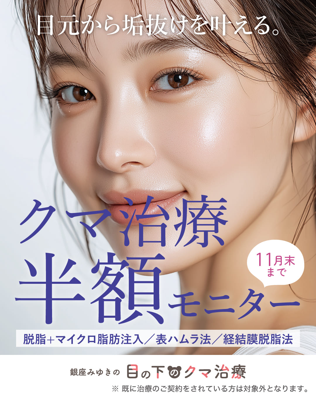 11月末までのキャンペーン北澤医師限定！目の下のくま脱脂＋脂肪注入594000円→220,000円！