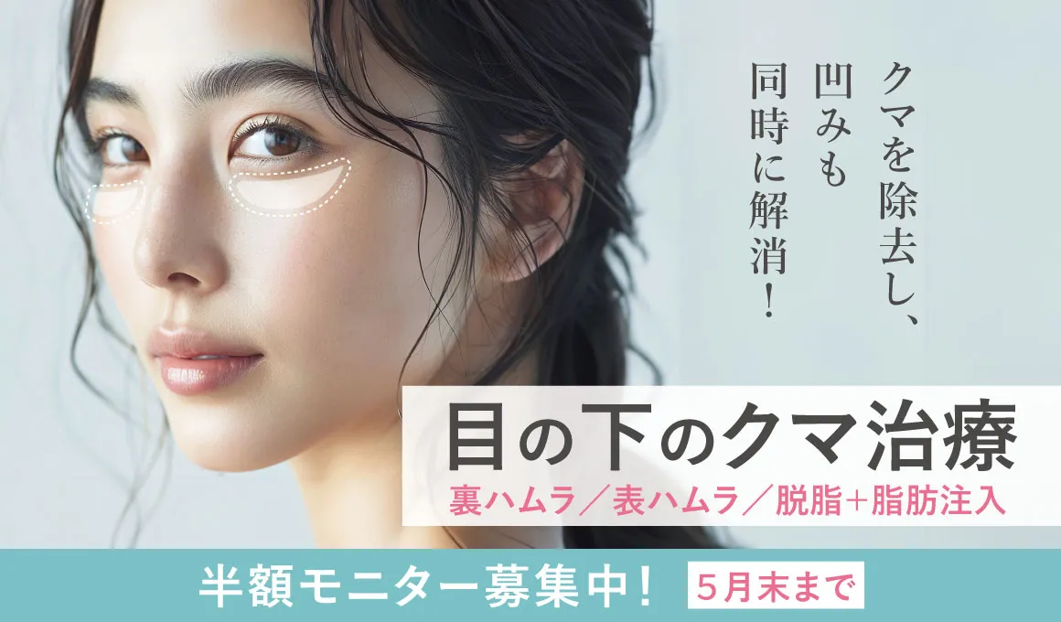 目の下のくま半額キャンペーン５月末まで