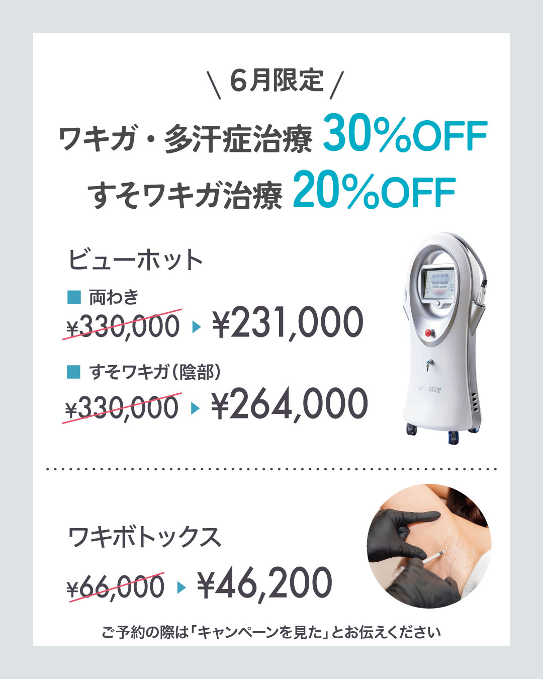 わきが多汗症30％OFFキャンペーン詳細！