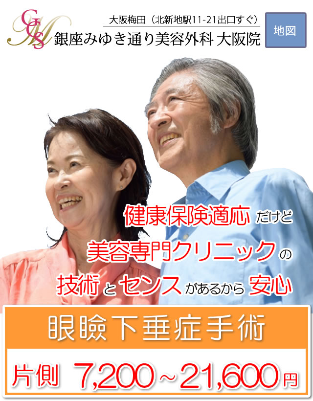 眼瞼下垂手術。片側7,200～21,600円（保険診療）銀座みゆき通り美容外科 大阪 / 梅田
