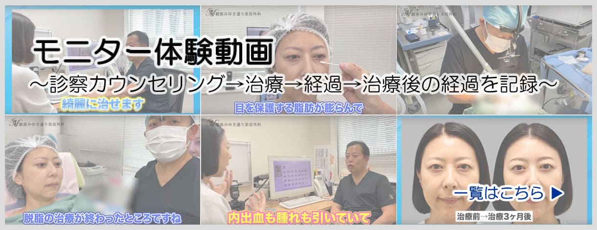 モニター症例№446（29歳 女性）脱脂コンデンスリポ