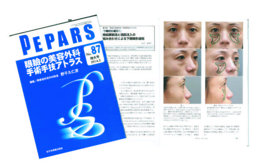 PEPARS87