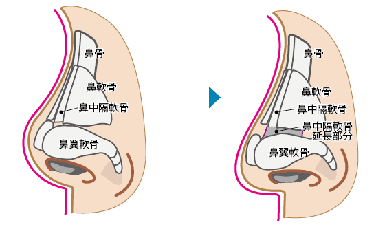 鼻の骨や軟骨の構造