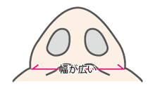 ループ固定法