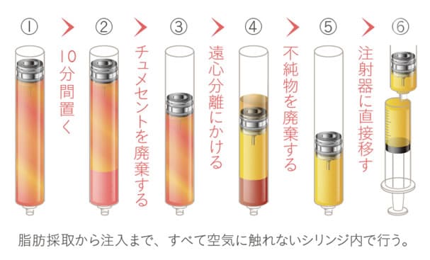 ＣＲＦ精製過程