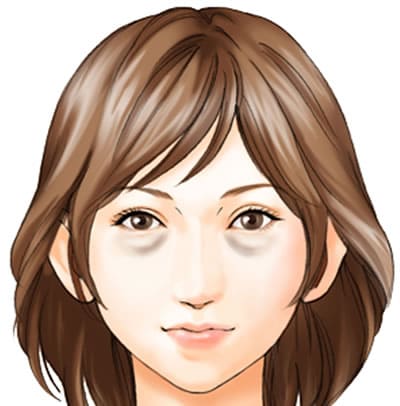 影グマ